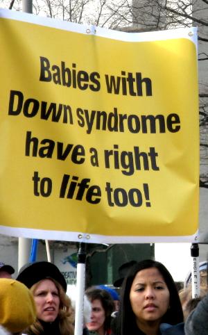 Banner at the March for Life: 'Babies with Down syndrome have a right to life too!'